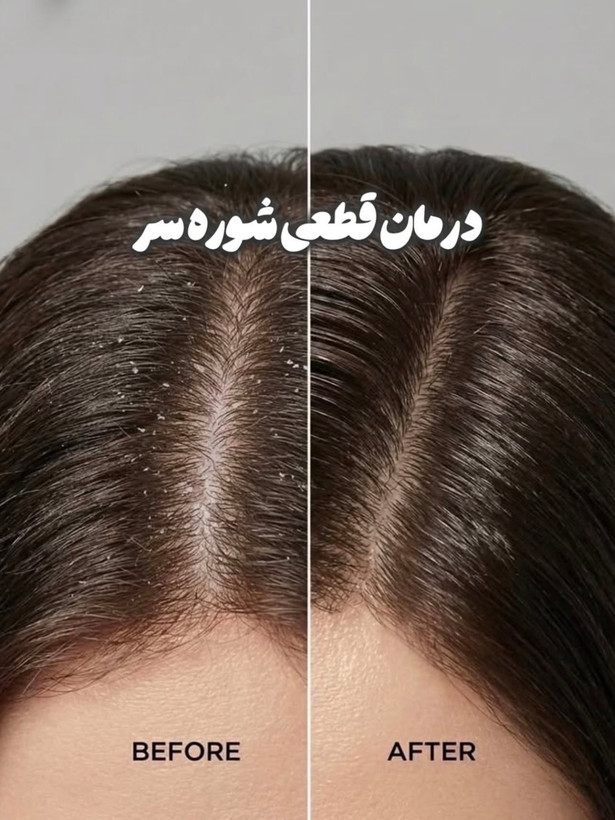 اسکراب کف سر لایتنس
